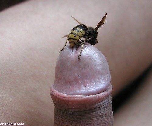 زنبور در موقعیت حساس